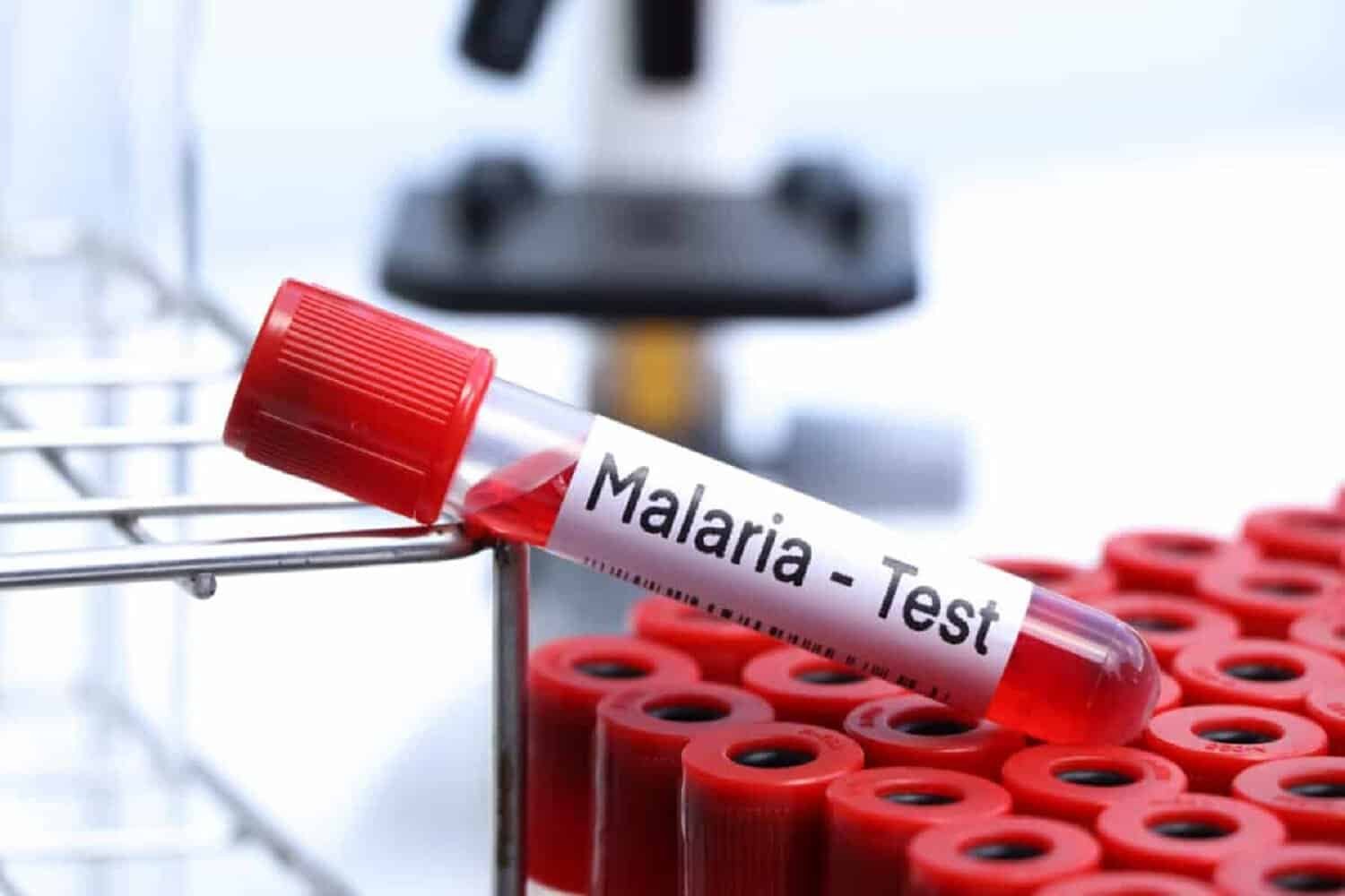surging-malaria-cases-in-gauteng-raise-alarm-as-death-toll-climbs